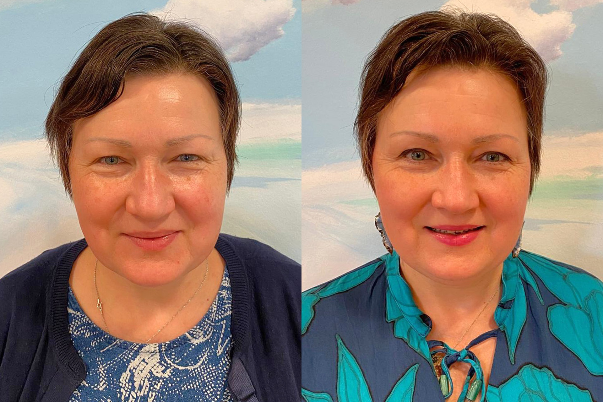 Deine Schönheit von Nase und Augen, von Gesicht und Figur